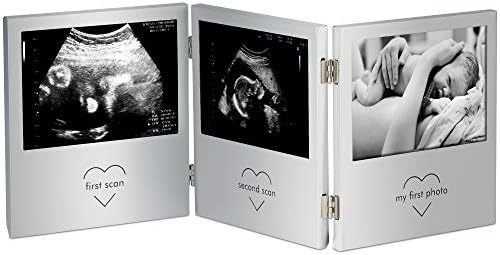 וונהאוס משולש סונוגרמה תמונה מסגרת למזכרת אולטרסאונד הריון סריקה תמונות ותינוק תמונות